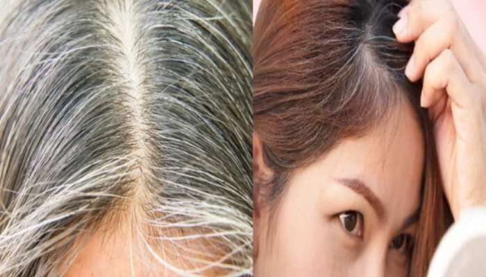 White Hair Problem: జుట్టు ఎందుకు తెల్లబడుతుంది, మీ డైట్‌లో ఈ విటమిన్ ఉంటే వైట్ హెయిర్ సమస్యకు చెక్