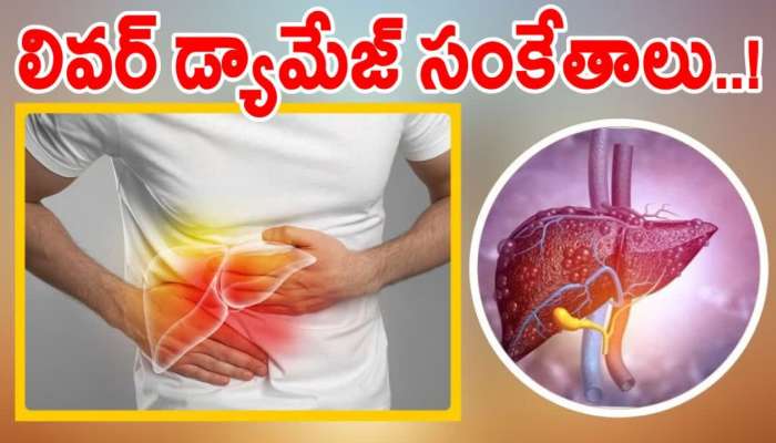 Liver: ఈ సంకేతాలు కనిపిస్తే మీ లివర్‌ డ్యామేజ్ అయినట్లే..!