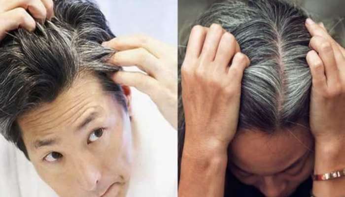 White Hair Problem: వైట్ హెయిర్ సమస్యకు కారణం ఇదే, ఈ విటమిన్ లోపం లేకుండా చూసుకోండి