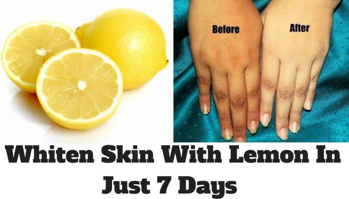 Lemon Juice: నిమ్మరసం ఇలా ఉపయోగిస్తే మళ్ళీ ముఖం మీద మొటిమలు రావు..! 