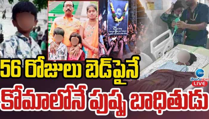 Pushpa 2: 56 రోజులు బెడ్ పైనే.. కోమాలోనే పుష్ప బాధితుడు..