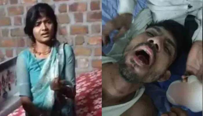 Viral News: ఇలా తయారయ్యారేంట్రా..?.. భర్త నాలుకను కొరికేసిన భార్య.. కారణం ఏంటో తెలుసా..? ..