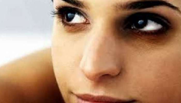 Dark Circles: ఈ విటమిన్లు లోపిస్తే కంటి కింద డార్క్ సర్కిల్స్ ఏర్పడుతాయని తెలుసా
