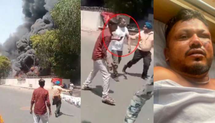 Vishwas Kumar Video: విమానం మంటల్లో నుంచి బిందాస్ గా బైటకు వస్తున్న రమేష్ విశ్వాస్.. లేటెస్ట్ వీడియో..