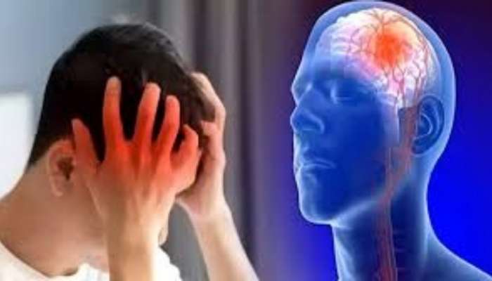 Brain Stroke Signs: నిర్లక్ష్యం వద్దు.. బ్రెయిన్‌ స్ట్రోక్‌ లక్షణాలు ఇవే.. సమయానికి గుర్తిస్తే ప్రాణాలను కాపాడొచ్చు..! 