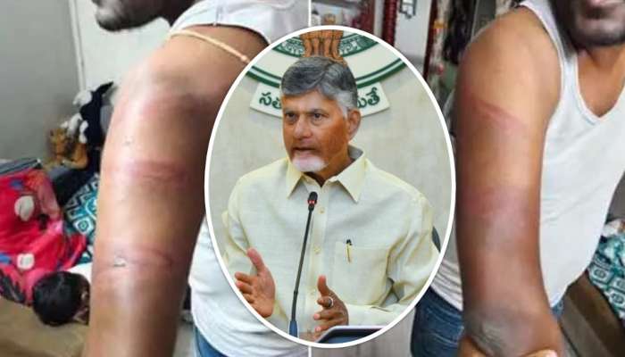 Podili Incident: పొదిలి సంఘటనపై సీఎం చంద్రబాబు సీరియస్.. విచారణకు ఆదేశం