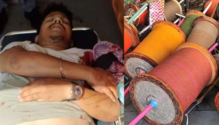 Hyderabad: హైదరాబాద్ లో ఘోరం.. చైనా మాంజా చుట్టుకుని తెగిన టెకీ చెయి.. ఏంజరిగిందంటే..?..