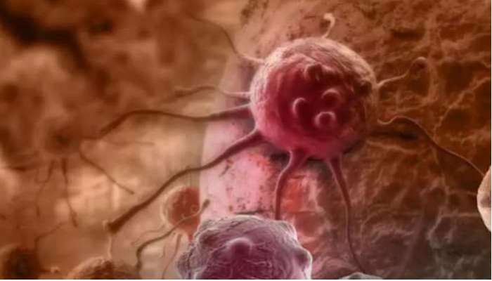 5 Cancer Causes: కొవ్వొత్తి నుంచి పెయింట్ వరకూ అన్నీ కేన్సర్ కారకాలే, ఈ 5 వస్తువులతో జాగ్రత్త