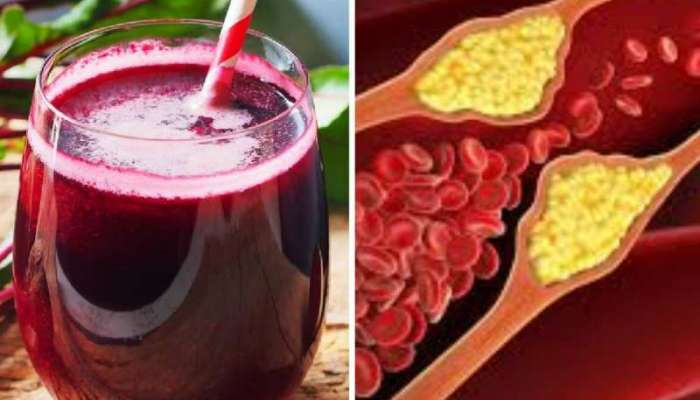 LDL Cholesterol Juices: రోజుకొక జ్యూస్ తాగితే కొలెస్ట్రాల్ ఎంత ఉన్నా ఇట్టే మాయం