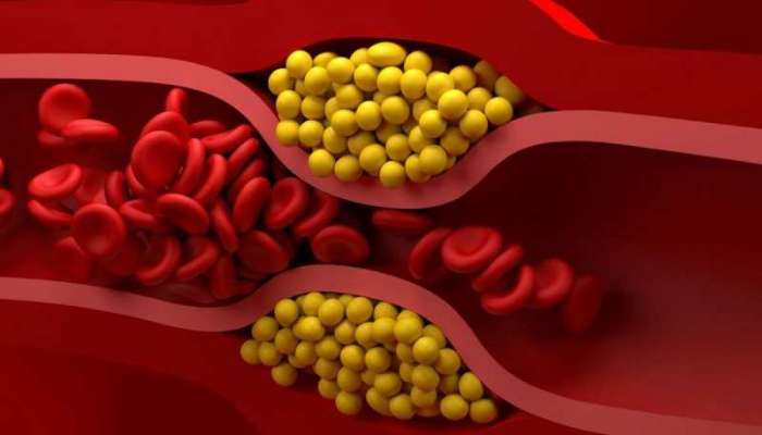 Cholesterol Remedies: డైట్‌లో ఈ పదార్ధాలు చేరిస్తే చెడు కొలెస్ట్రాల్ ఇట్టే దూరం