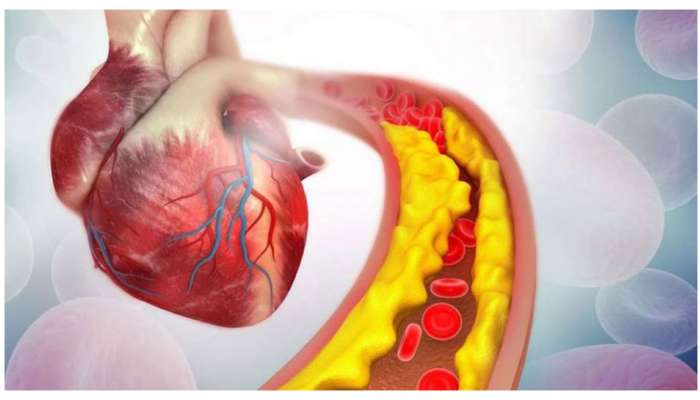 Cholesterol: ఈ 5 కూరగాయలు కొలెస్ట్రాల్ తగ్గించేస్తాయి.. ఈరోజే మీ డైట్లో చేర్చుకోండి..
