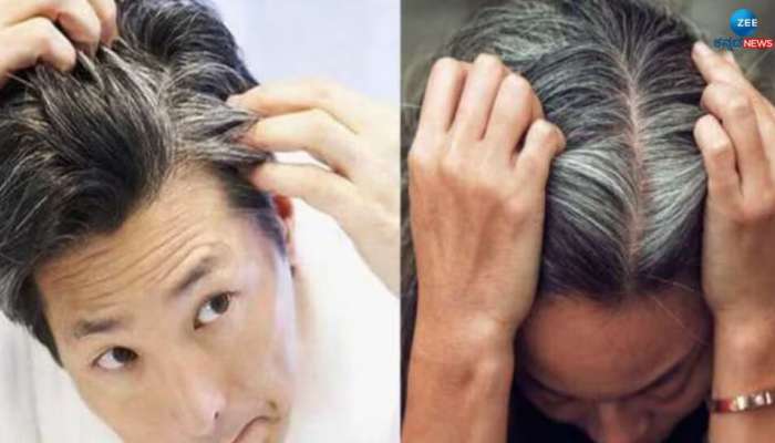  White Hair Home Remedies: వంటింట్లో దొరికే ఈ వస్తువులను Hennaలో కలిపి తలకు పెడితే తెల్లవెంట్రుక రమ్మన్నారాదు 