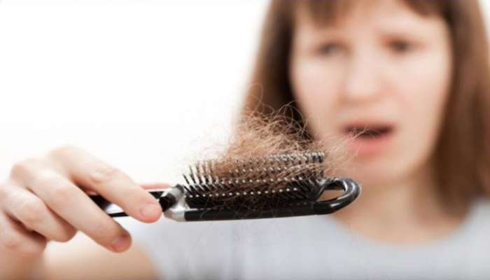 Hair Care:  జుట్టు దువ్వుతుంటే వెంట్రుకలు ఊడుతున్నాయా.. అయితే ఈ చిట్కాలు పాటిస్తే మీ జుట్టు ఊడమన్నా ఊడదు