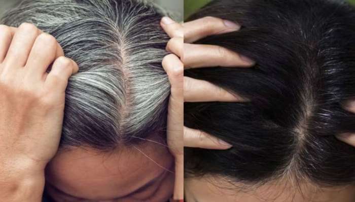 White Hair: రాత్రి పడుకునే ముందు జుట్టుకు ఈ నూనె రాస్తే చాలు కుదుళ్ల నుంచి నల్లగా మారిపోతుంది..