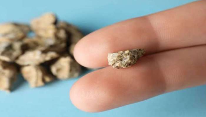 Kidney Stone: ఈ ఆకు ఎంత పెద్ద రాయి అయినా సరే శస్త్ర చికిత్స లేకుండానే బయటకు ఫ్లష్‌ చేస్తుంది..