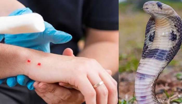 Snake Bite: పాము కాటు వేస్తే వెంటనే ఈ కూరగాయతో రుద్దండి.. విషం వ్యాపించదు..