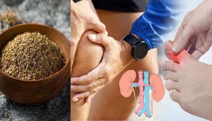 Uric Acid: ఇది ఒక్క చెంచా నోట్లో వేసుకోండి.. యూరిక్‌ యాసిడ్‌ పత్తా లేకుండా పోతుంది..!