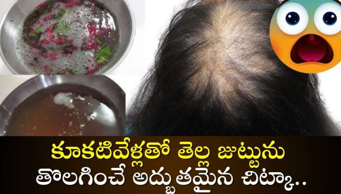 White Hair Problem: కూకటివేళ్లతో తెల్ల జుట్టును తొలగించే అద్భుతమైన చిట్కా.. రూపాయి ఖర్చు పెట్టనక్కర్లేదు!