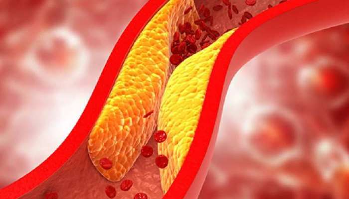 Cholesterol Diet: మీ డైట్‌లో ఈ 4 పదార్ధాలుంటే కొలెస్ట్రాల్ సమూలంగా నిర్మూలన