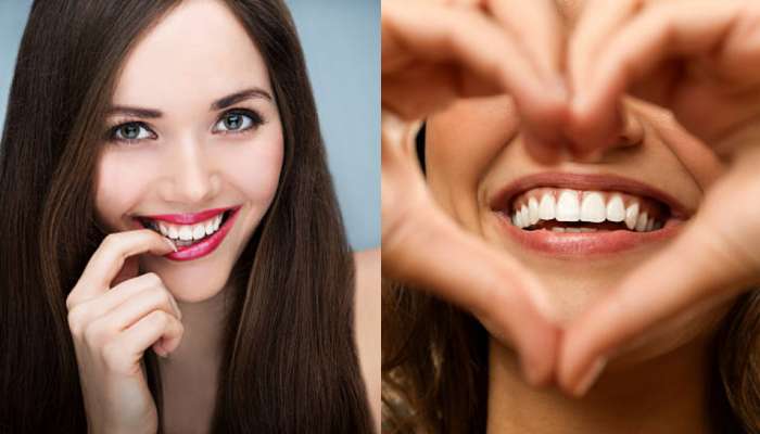 Teeth Whitening Tips: మీ దంతాలు పచ్చగా ఉన్నాయా..?.. ఈ సింపుల్ టిప్స్ పాటిస్తే ముత్యాల్లా మెరుస్తాయి..