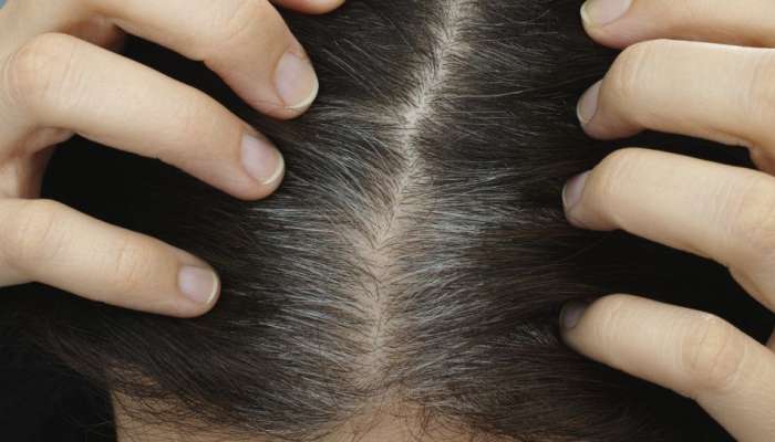 Foods For White Hair: ఇవి తింటే.. రంగుతో పనే ఉండదు.. తెల్ల జుట్టు కాస్తా నల్లగా మారడమే కాదు.. రమ్మన్నారాదు