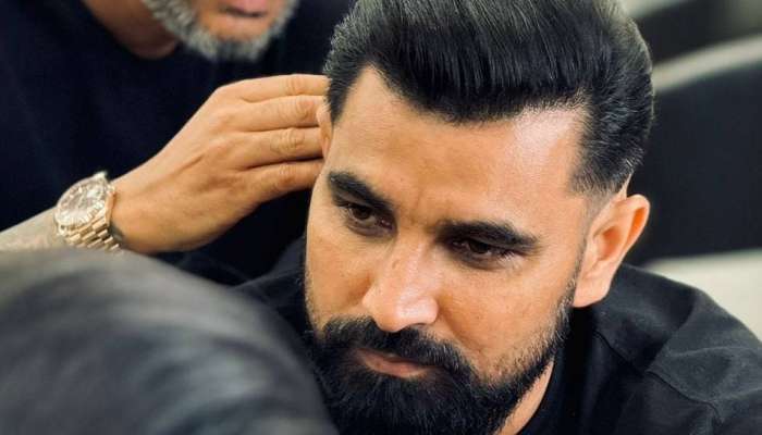 Bald Hair: క్రికెటర్‌ మహ్మద్‌ షమీ బట్టతల సమస్య ఎలా తగ్గింది? చక్కటి హెయిర్‌ స్టైల్‌కు కారణం ఇదే!