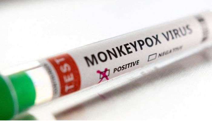 Monkeypox in India: ఇండియాలో మంకీపాక్స్ కలవరం, లక్షణాలు, చికిత్స, టెస్ట్ ఎలా ఉంటాయి