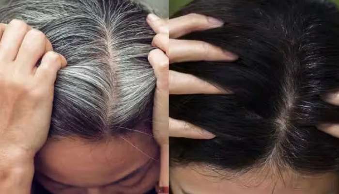 White to Black hair: ఈ నూనె వాడటం ద్వారా తెల్ల జుట్టు పెర్మనెంట్గా.. నల్లగా మారుతుంది అని తెలుసా..
