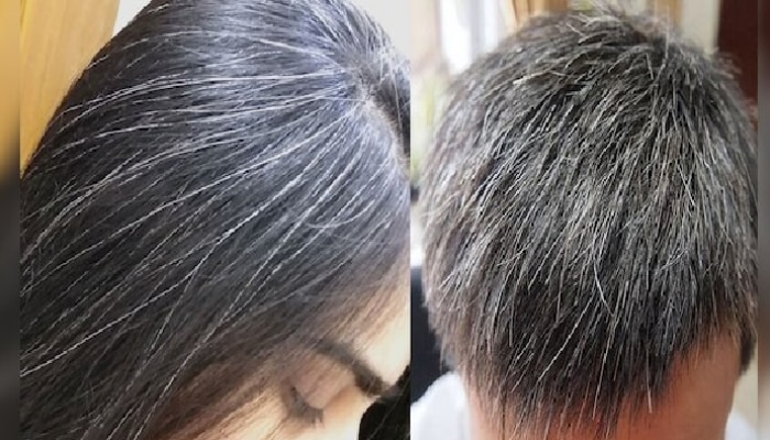 Black Hair Remedy: మీ తెల్ల జుట్టు శాశ్వతంగా నల్లబర్చే శక్తివంతమైన ఆయుధం ఇదే