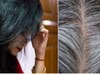 White Hair Remedy తెల్ల జుట్టు శాశ్వతంగా నల్లబడే మార్గం